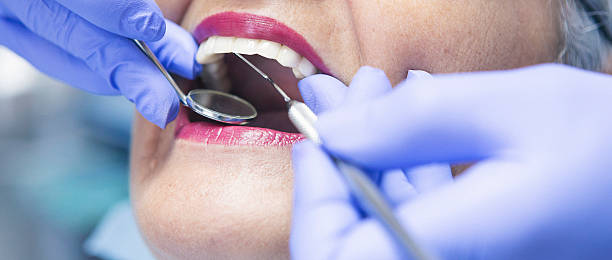 Best Emergency Cosmetic Dentistry (e.g., broken veneers) in Madison, GA